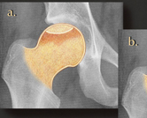 Fall 2015 Best Case MSK